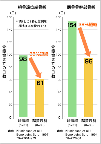 超音波治療法で治療期間が約40％も短縮