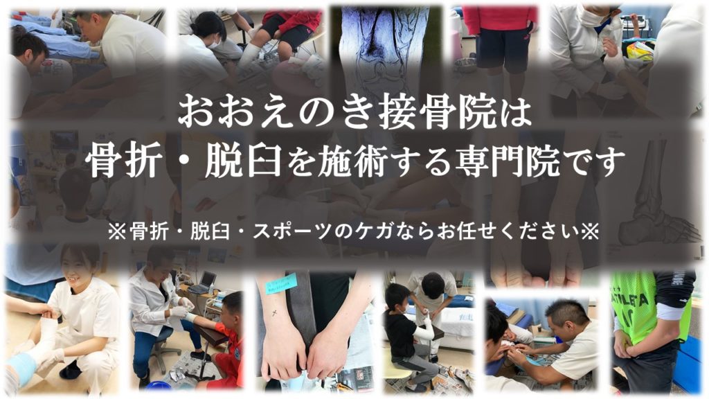 おおえのき接骨院は 骨折・脱臼を施術する専門院です ※骨折・脱臼・スポーツのケガならお任せください※