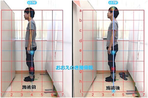 施術前と施術後の体の状態