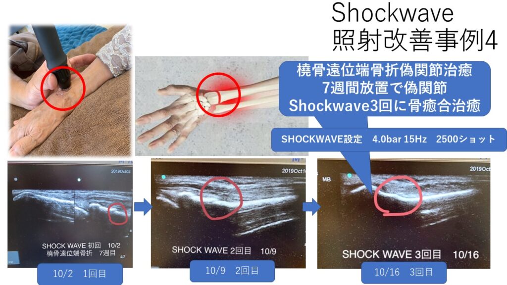 三重県鈴鹿市 おおえのき接骨院 外傷 腰痛 交通事故など痛みのことはお任せください