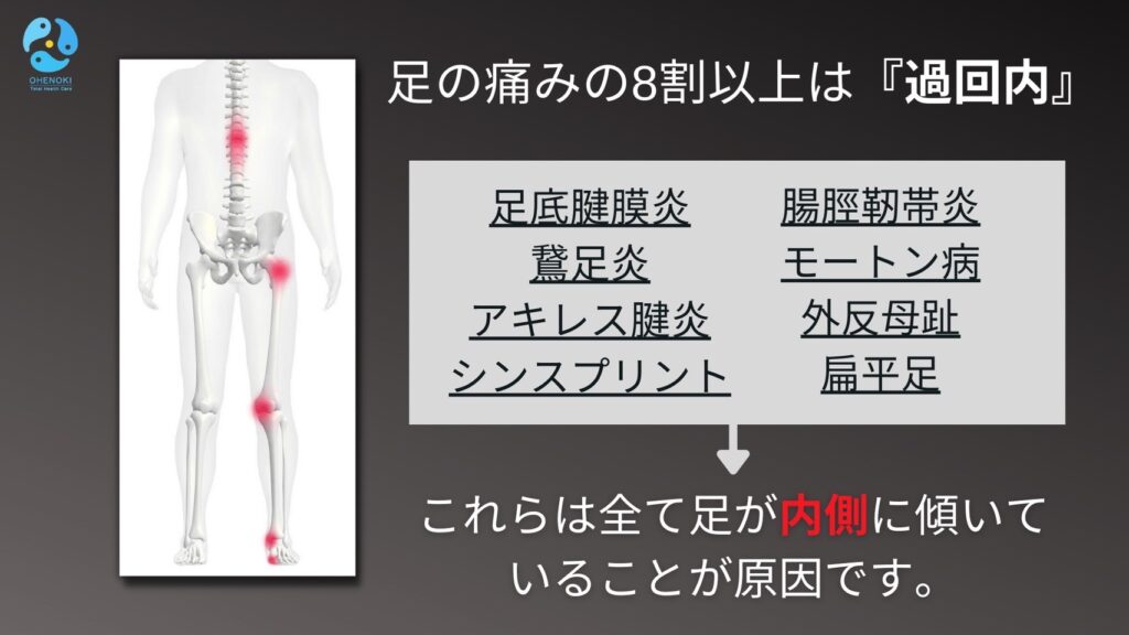 足底腱膜炎、鵞足炎、アキレス腱炎、シンスプリント、腸脛靭帯炎、モートン病、外反母趾、扁平足　これらはすべて足が内側に傾いていることが原因です。